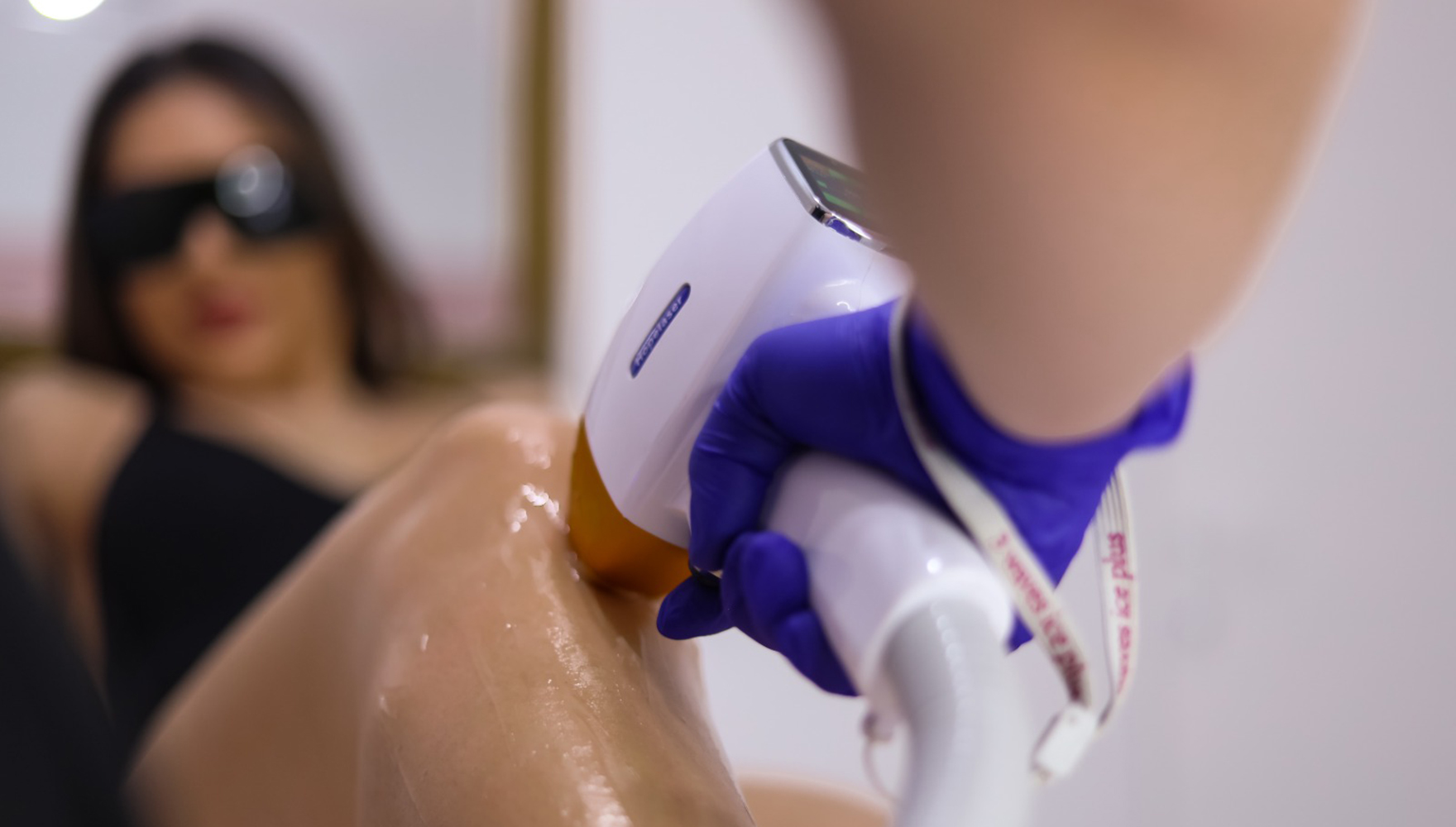 epilare definitiva cluj